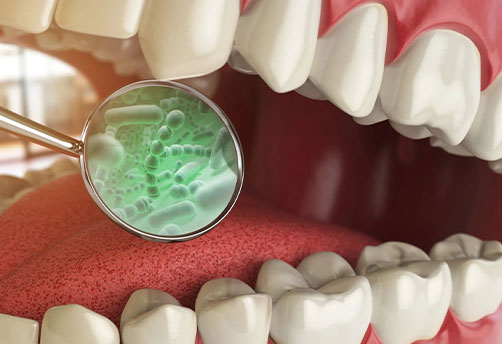 Dental bacteria
